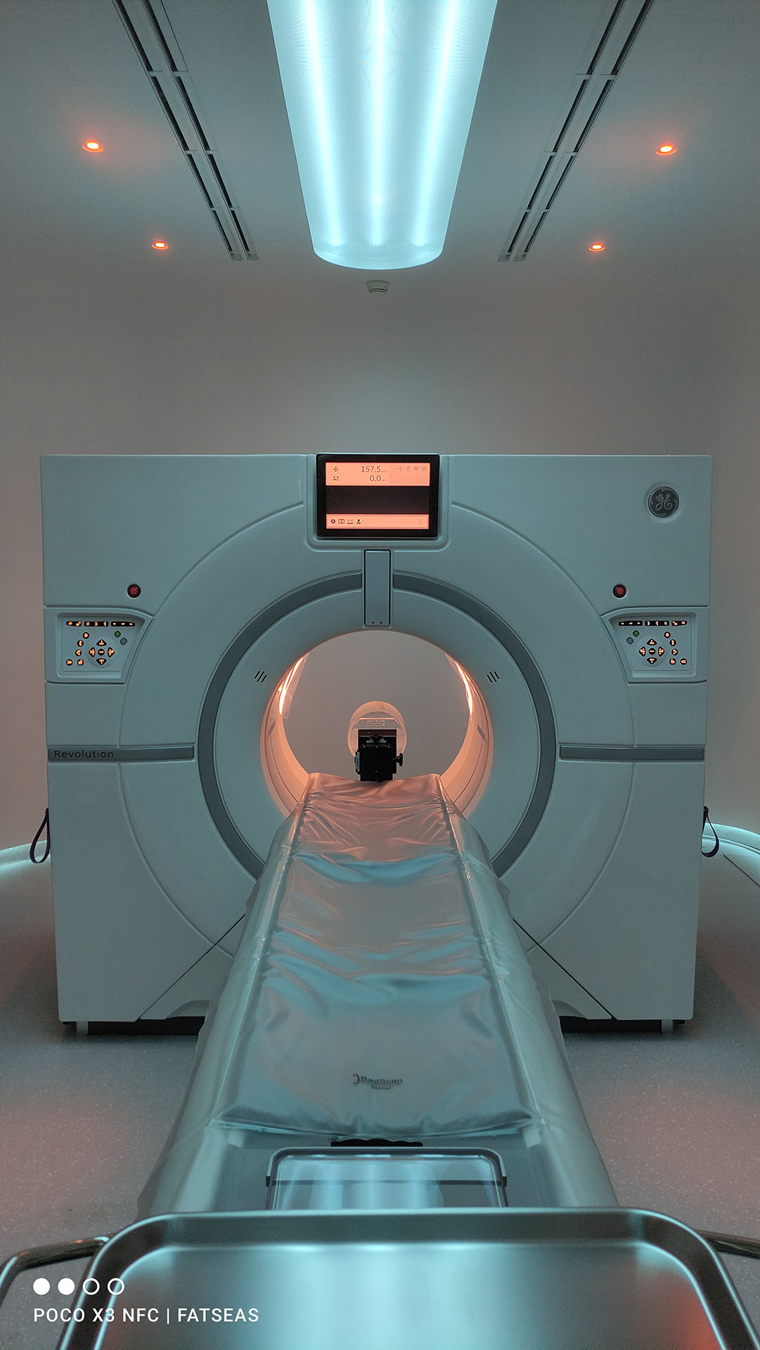 CT Scan Revolution